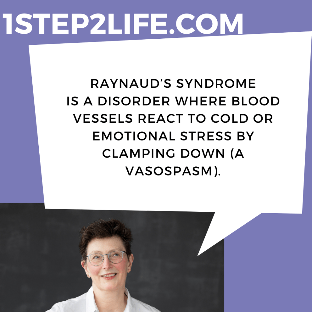 Raynaud’s Syndrome