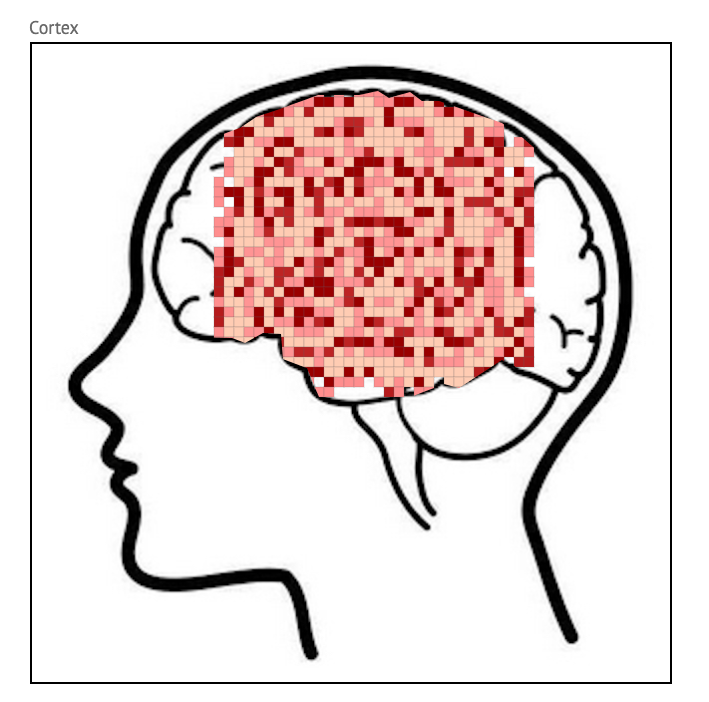 Max Kramer models migraine spreading depression